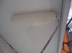 黒ずみ　落とす