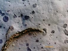 診断　マイクロスコープ