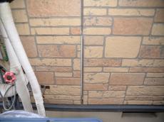 痛み　シーリング